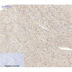 Akt1兔多抗,Akt1 Rabbit Polyclonal Antibody