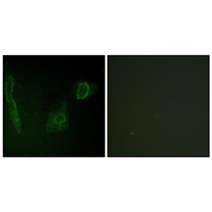 ALK兔多抗,ALK Rabbit Polyclonal Antibody