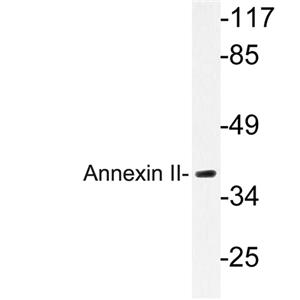 Annexin II兔多抗,Annexin II Rabbit Polyclonal Antibody