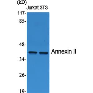Annexin II兔多抗,Annexin II Rabbit Polyclonal Antibody