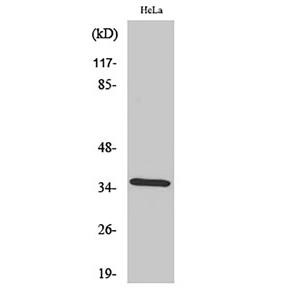 Annexin II兔多抗,Annexin II Rabbit Polyclonal Antibody