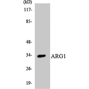 Arginase I兔多抗,Arginase I Rabbit Polyclonal Antibody