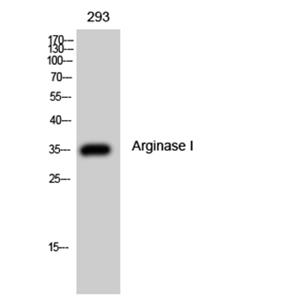 Arginase I兔多抗,Arginase I Rabbit Polyclonal Antibody