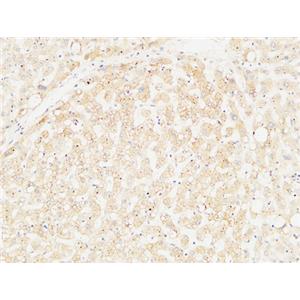 Arginase I兔多抗,Arginase I Rabbit Polyclonal Antibody