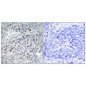 ARK-1兔多抗,ARK-1 Rabbit Polyclonal Antibody
