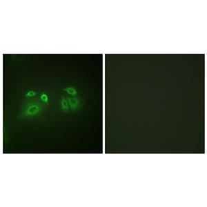 Arrestin-β-1兔多抗,Arrestin-β-1 Rabbit Polyclonal Antibody