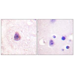 Arrestin-β-1兔多抗,Arrestin-β-1 Rabbit Polyclonal Antibody