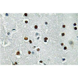ASCL1兔多抗,ASCL1 Rabbit Polyclonal Antibody