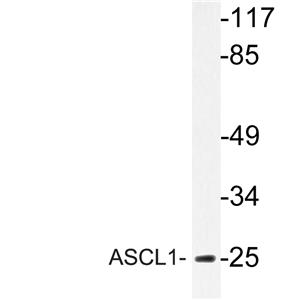 ASCL1兔多抗,ASCL1 Rabbit Polyclonal Antibody