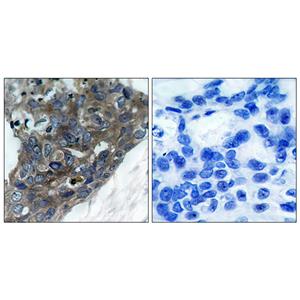 ASK 1兔多抗,ASK 1 Rabbit Polyclonal Antibody