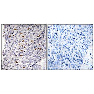 ATF-1兔多抗,ATF-1 Rabbit Polyclonal Antibody