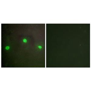 ATRX兔多抗,ATRX Rabbit Polyclonal Antibody