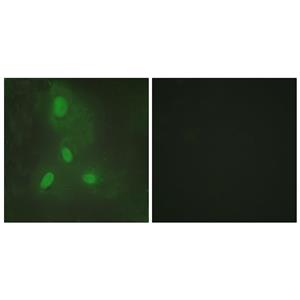 BACH1兔多抗,BACH1 Rabbit Polyclonal Antibody