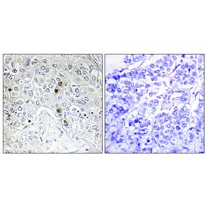 B-ATF兔多抗,B-ATF Rabbit Polyclonal Antibody