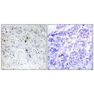B-ATF兔多抗,B-ATF Rabbit Polyclonal Antibody