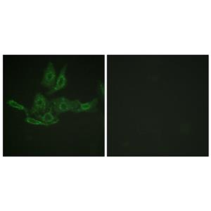 Bcl-2兔多抗,Bcl-2 Rabbit Polyclonal Antibody