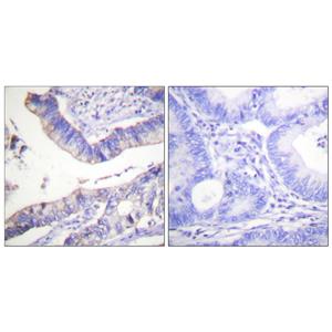 Bcl-2兔多抗,Bcl-2 Rabbit Polyclonal Antibody