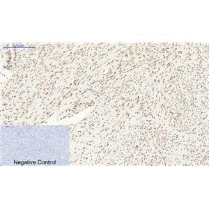 Bcl-6兔多抗,Bcl-6 Rabbit Polyclonal Antibody