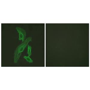 Bcl-x兔多抗,Bcl-x Rabbit Polyclonal Antibody