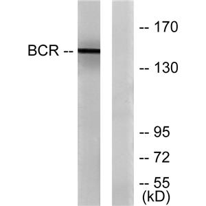 Bcr兔多抗,Bcr Rabbit Polyclonal Antibody