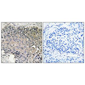 Bcr兔多抗,Bcr Rabbit Polyclonal Antibody
