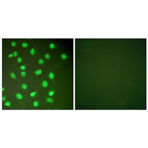 BM28兔多抗,BM28 Rabbit Polyclonal Antibody
