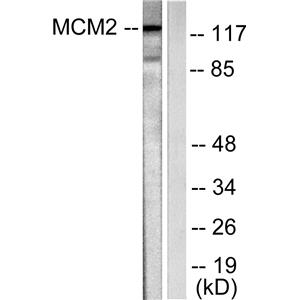 BM28兔多抗,BM28 Rabbit Polyclonal Antibody