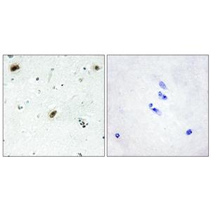 c-Abl兔多抗,c-Abl Rabbit Polyclonal Antibody