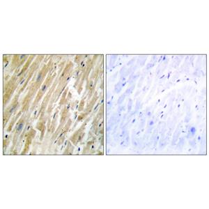 Calregulin兔多抗,Calregulin Rabbit Polyclonal Antibody