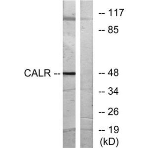 Calregulin兔多抗,Calregulin Rabbit Polyclonal Antibody