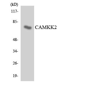 CaMKK2兔多抗,CaMKK2 Rabbit Polyclonal Antibody