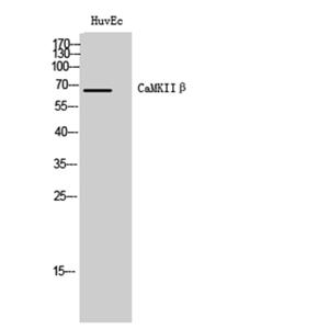 CaMKK2兔多抗,CaMKK2 Rabbit Polyclonal Antibody
