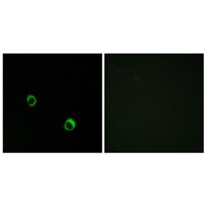 CARD 14兔多抗,CARD 14 Rabbit Polyclonal Antibody