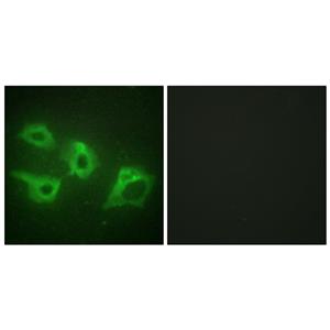 Casein Kinase Iα兔多抗,Casein Kinase Iα Rabbit Polyclonal Antibody