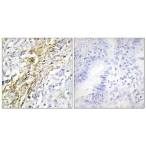 Casein Kinase Iα兔多抗,Casein Kinase Iα Rabbit Polyclonal Antibody