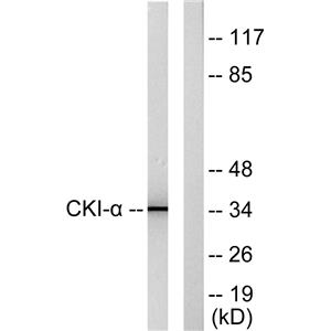 Casein Kinase Iα兔多抗,Casein Kinase Iα Rabbit Polyclonal Antibody