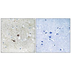Caspase-2兔多抗,Caspase-2 Rabbit Polyclonal Antibody