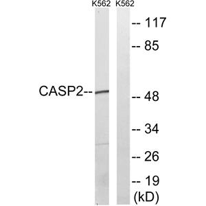 Caspase-2兔多抗,Caspase-2 Rabbit Polyclonal Antibody