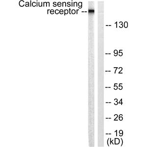 CaSR兔多抗,CaSR Rabbit Polyclonal Antibody