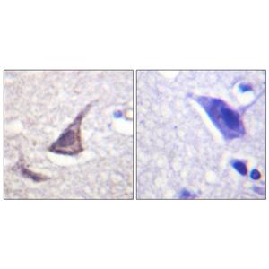 CaSR兔多抗,CaSR Rabbit Polyclonal Antibody