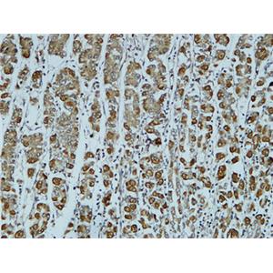 Catenin-α1兔多抗,Catenin-α1 Rabbit Polyclonal Antibody