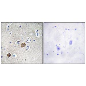 Catenin-α1兔多抗,Catenin-α1 Rabbit Polyclonal Antibody