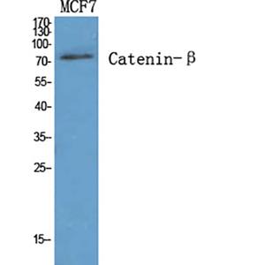 Catenin-β兔多抗,Catenin-β Rabbit Polyclonal Antibody