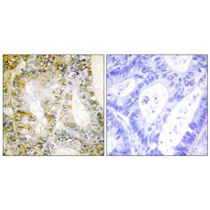 Catenin-β1兔多抗,Catenin-β1 Rabbit Polyclonal Antibody