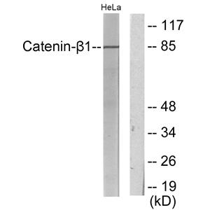 Catenin-β1兔多抗,Catenin-β1 Rabbit Polyclonal Antibody