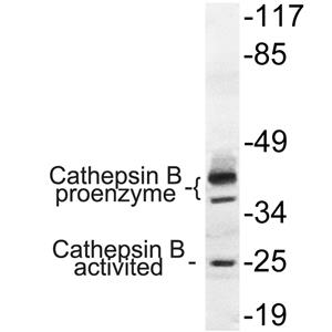 Cathepsin B兔多抗,Cathepsin B Rabbit Polyclonal Antibody