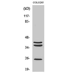 Cathepsin B兔多抗,Cathepsin B Rabbit Polyclonal Antibody