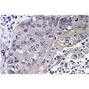 Cathepsin?D兔多抗,Cathepsin?D Rabbit Polyclonal Antibody