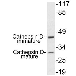 Cathepsin?D兔多抗,Cathepsin?D Rabbit Polyclonal Antibody