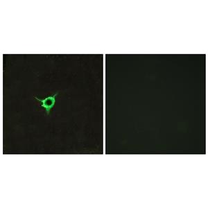 CB1兔多抗,CB1 Rabbit Polyclonal Antibody